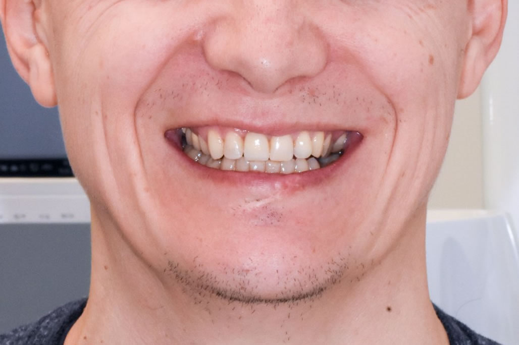 poslije2 poslije2