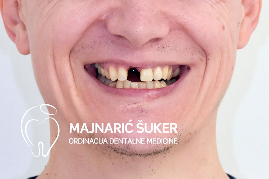 prije2 prije2